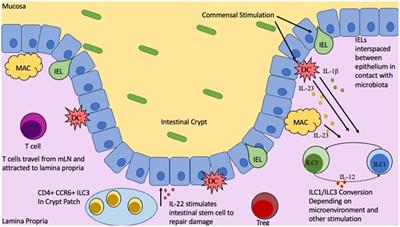 Microbiota as key factors in inflammatory bowel disease